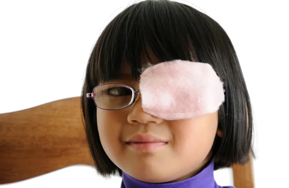 การรักษาโรคตาขี้เกียจ